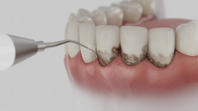 Trusted Teeth Whitening service in Bluffton, SC - Dentist Open Now